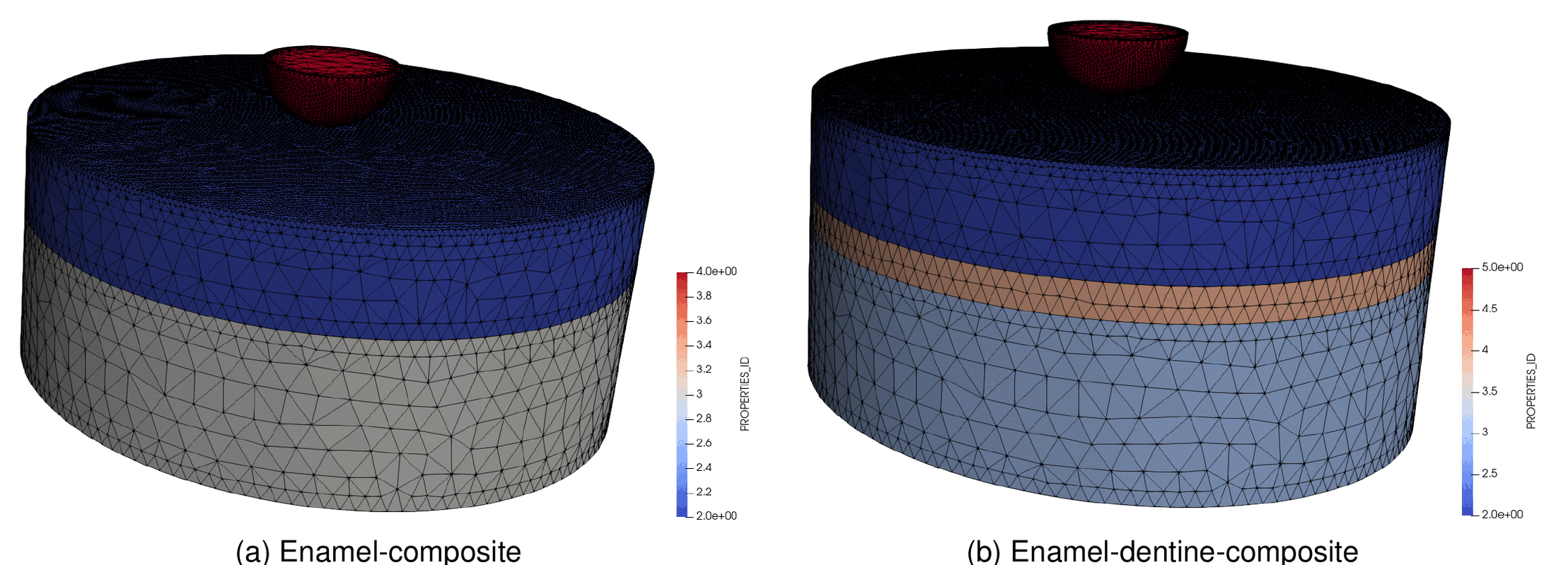 Teeth layers models: enamel-composite and enamel-dentine-composite