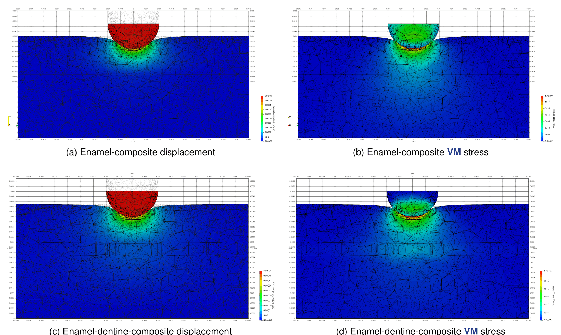 Displacement and von Mises stress of the two teeth models